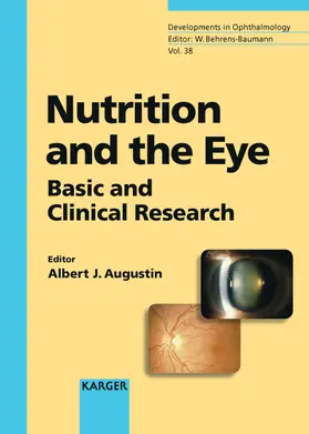 Augustin |  Nutrition and the Eye | Buch |  Sack Fachmedien