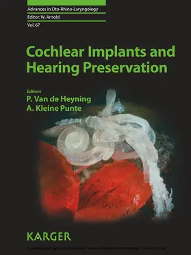 Van de Heyning / Kleine Punte |  Cochlear Implants and Hearing Preservation | eBook | Sack Fachmedien