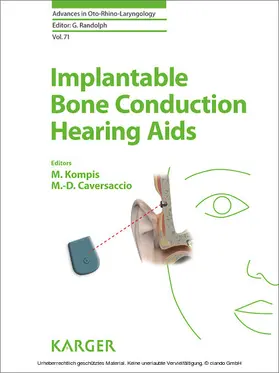 Kompis / Caversaccio |  Implantable Bone Conduction Hearing Aids | eBook | Sack Fachmedien