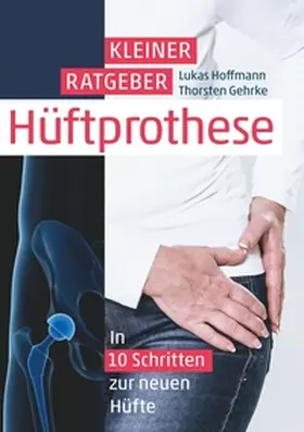 Hoffmann / Gehrke |  Kleiner Ratgeber Hüftprothese | Buch |  Sack Fachmedien