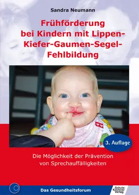Neumann |  Frühförderung bei Kindern mit Lippen-Kiefer-Gaumen-Segel-Fehlbildung | eBook | Sack Fachmedien
