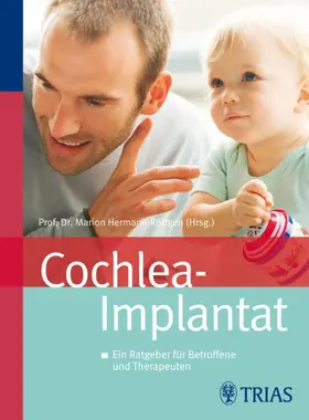 Hermann-Röttgen |  Cochlea-Implantat | eBook | Sack Fachmedien