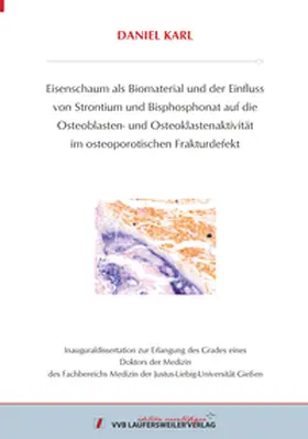 Karl |  Eisenschaum als Biomaterial und der Einfluss von Stron-tium und Bisphosphonat auf die Osteoblasten- und Os-teoklastenaktivität im osteoporotischen Frakturdefekt | Buch |  Sack Fachmedien