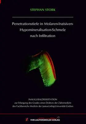 Stork |  Penetrationstiefe in Molaren-Inzisiven-Hypomineralisation-Schmelz nach Infiltration | Buch |  Sack Fachmedien