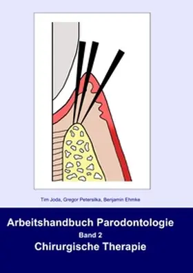 Joda / Petersilka / Ehmke |  Arbeitshandbuch Parodontologie | Buch |  Sack Fachmedien