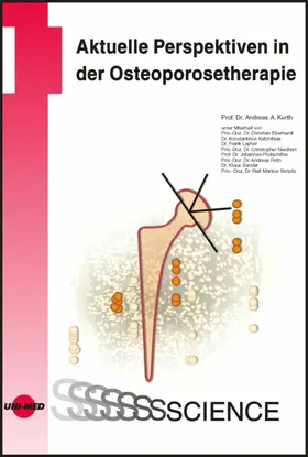 Kurth |  Aktuelle Perspektiven in der Osteoporosetherapie | eBook | Sack Fachmedien