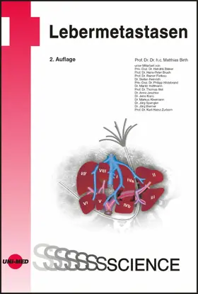 Birth |  Lebermetastasen | eBook | Sack Fachmedien