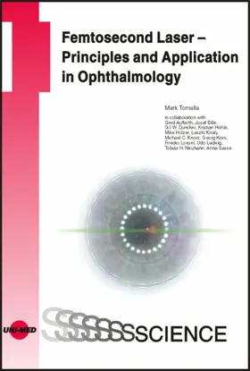 Tomalla |  Femtosecond Laser - Principles and Application in Ophthalmology | eBook | Sack Fachmedien