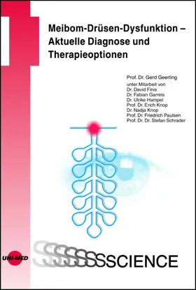 Geerling |  Meibom-Drüsen-Dysfunktion - Aktuelle Diagnose und Therapieoptionen | eBook | Sack Fachmedien