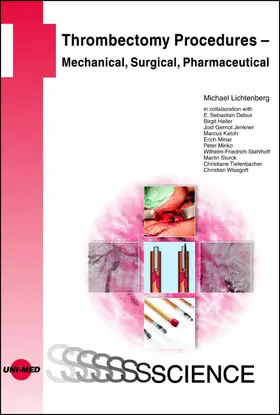 Lichtenberg |  Thrombectomy Procedures - Percutaneous Mechanical, Vascular Surgical, Pharmaceutical | eBook | Sack Fachmedien