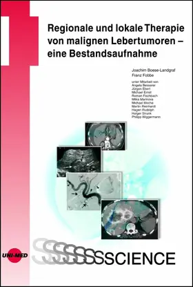 Boese-Landgraf / Fobbe |  Regionale und lokale Therapie von malignen Lebertumoren - eine Bestandsaufnahme | eBook | Sack Fachmedien