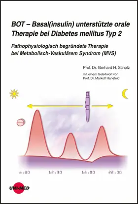 Scholz |  BOT - Basal(insulin) unterstützte orale Therapie bei Diabetes mellitus Typ 2 | eBook | Sack Fachmedien