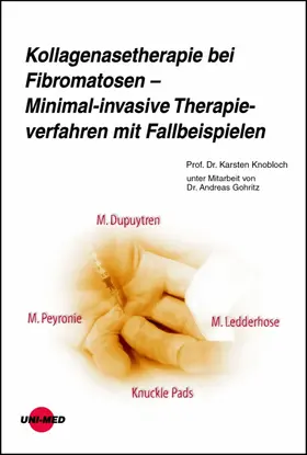Knobloch |  Kollagenasetherapie bei Fibromatosen - Minimal-invasive Therapieverfahren mit Fallbeispielen | eBook | Sack Fachmedien