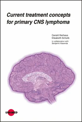 Illerhaus / Schorb |  Current treatment concepts for primary CNS lymphoma | eBook | Sack Fachmedien