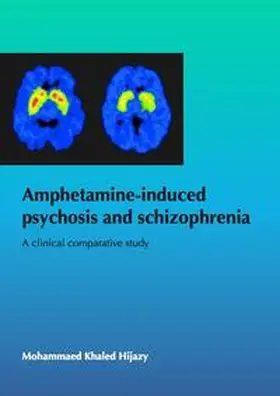 Hijazy |  Amphetamine-induced psychosis and schizophrenia: A clinical comparative study | Buch |  Sack Fachmedien