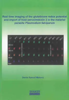 Kasozi Matovu |  Real time imaging of the glutathione redox potential and import of host peroxiredoxin 2 in the malarial parasite Plasmodium falciparum | Buch |  Sack Fachmedien