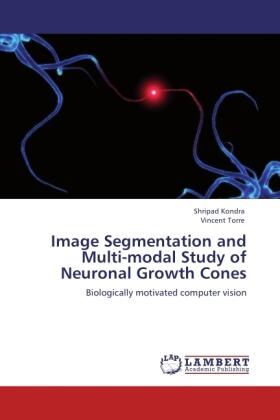 Kondra / Torre |  Image Segmentation and Multi-modal Study of Neuronal Growth Cones | Buch |  Sack Fachmedien