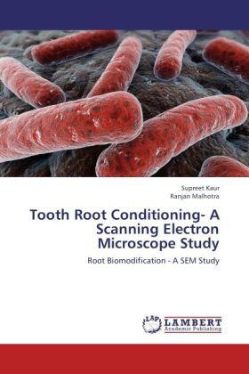 Kaur / Malhotra |  Tooth Root Conditioning- A Scanning Electron Microscope Study | Buch |  Sack Fachmedien