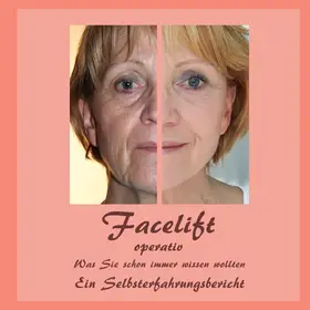 Siegmund / Fischer |  Facelift operativ | eBook | Sack Fachmedien