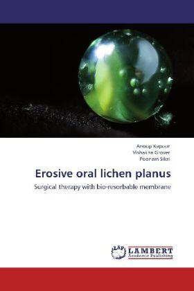 Kapoor / Grover / Sikri |  Erosive oral lichen planus | Buch |  Sack Fachmedien