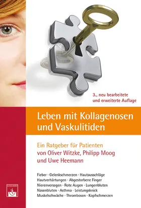 Witzke / Moog / Heemann |  Leben mit Kollagenosen und Vaskulitiden | Buch |  Sack Fachmedien