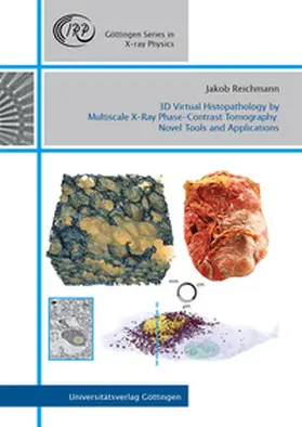 Reichmann |  3D Virtual Histopathology by Multiscale X-Ray Phase-Contrast Tomography: Novel Tools and Applications | Buch |  Sack Fachmedien