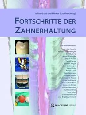 Lussi / Schaffner | Fortschritte der Zahnerhaltung | Buch | 978-3-86867-019-6 | sack.de