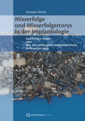 Foitzik |  Misserfolge und Misserfolgsstorys in der Implantologie | eBook | Sack Fachmedien