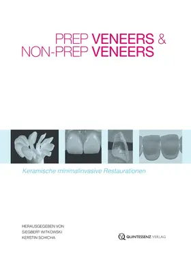 Witkowski / Schicha |  Prep Veneers und Non-Prep Veneers | eBook | Sack Fachmedien