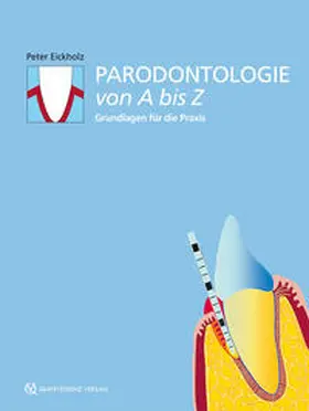 Eickholz / Baron / Bürklin |  Parodontologie von A bis Z | Buch |  Sack Fachmedien