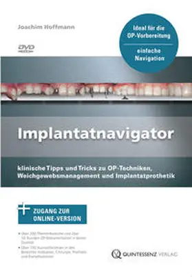 Hoffmann | Implantatnavigator | Sonstiges | 978-3-86867-213-8 | sack.de