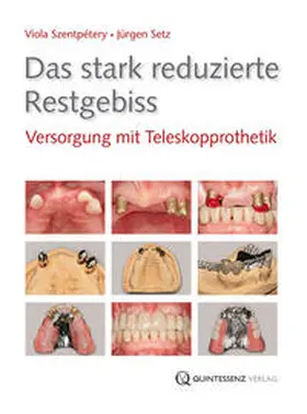 Szentpétery / Setz |  Das stark reduzierte Restgebiss | Buch |  Sack Fachmedien