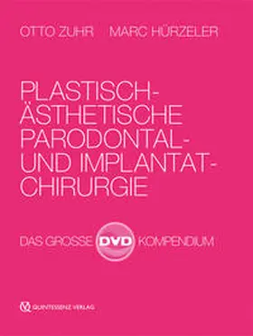 Zuhr / Hürzeler | Plastisch-Ästhetische Parodontal- und Implantatchirurgie | Sonstiges | 978-3-86867-310-4 | sack.de