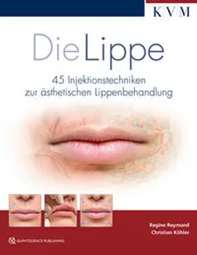 Reymond / Köhler |  Die Lippe | Buch |  Sack Fachmedien