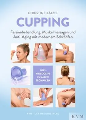 Kätzel | Cupping | Buch | 978-3-86867-485-9 | www2.sack.de