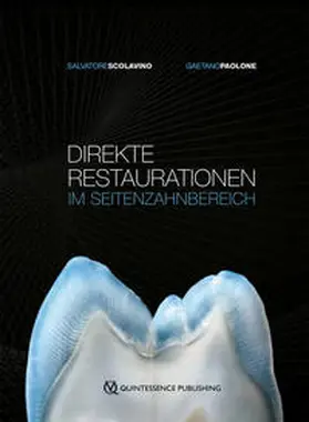 Scolavino / Paolone |  Direkte Restaurationen im Seitenzahnbereich | Buch |  Sack Fachmedien