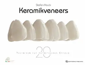 Koubi |  Keramikveneers | eBook | Sack Fachmedien