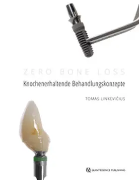 Linkevicius / Linkevicius | Zero Bone Loss: Knochenerhaltende Behandlungskonzepte | E-Book | sack.de