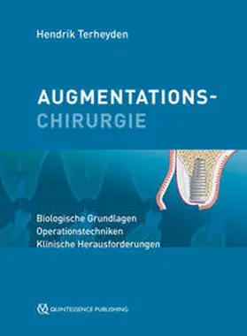 Terheyden | Augmentationschirurgie | Buch | 978-3-86867-548-1 | sack.de