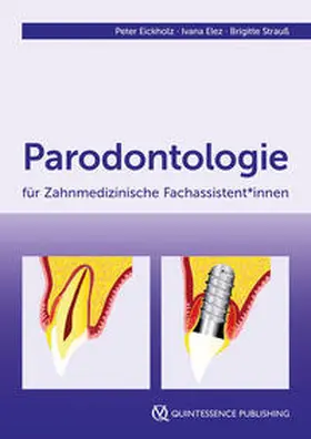 Eickholz / Elez / Strauß |  Parodontologie für Zahnmedizinische Fachassistent*innen | Buch |  Sack Fachmedien