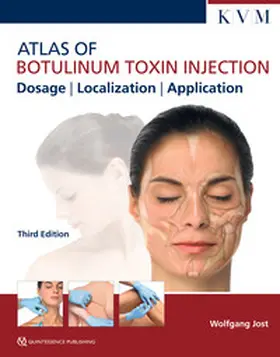 Jost |  Atlas of Botulinum Toxin Injection | eBook | Sack Fachmedien