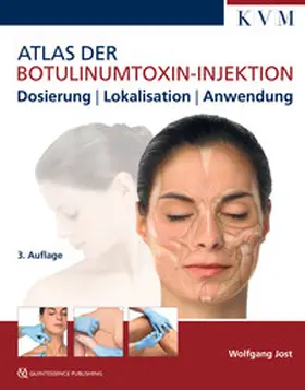 Jost |  Atlas der Botulinumtoxin-Injektion | eBook | Sack Fachmedien
