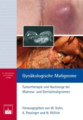 Kuhn / Possinger / Willich |  Gynäkologische Malignome | Buch |  Sack Fachmedien