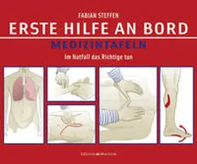 Steffen | Erste Hilfe an Bord – Medizintafeln | Buch | 978-3-89225-669-4 | sack.de