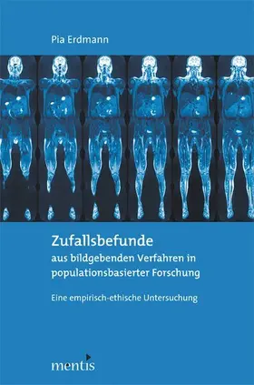 Erdmann |  Zufallsbefunde aus bildgebenden Verfahren in populationsbasierter Forschung | Buch |  Sack Fachmedien
