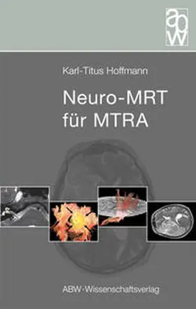Hoffmann |  Neuro-MRT für MTRA | Buch |  Sack Fachmedien