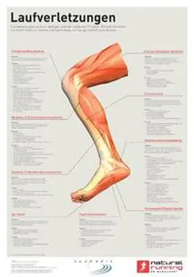 Marquardt |  Laufverletzungen | Sonstiges |  Sack Fachmedien