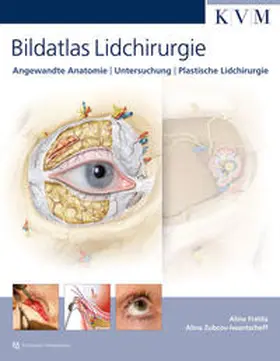 Fratila / Zubcov-Iwantscheff |  Bildatlas Lidchirurgie | Buch |  Sack Fachmedien