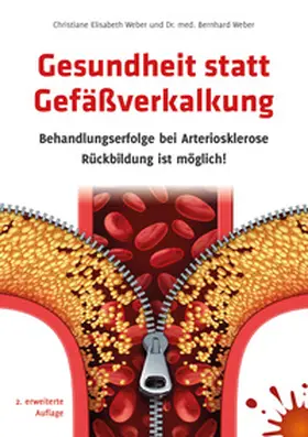 Weber |  Gesundheit statt Gefäßverkalkung | eBook | Sack Fachmedien