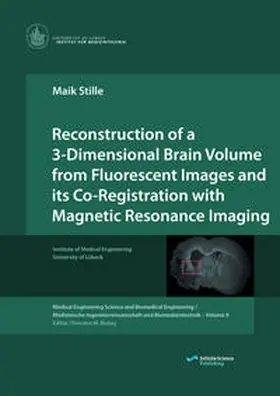 Stille |  Reconstruction of a 3-Dimensional Brain Volume from Fluorescent Images and its Co-Registration with Magnetic Resonance Imaging | Buch |  Sack Fachmedien